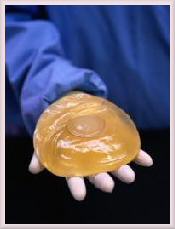 implant2.jpg (7556 bytes)